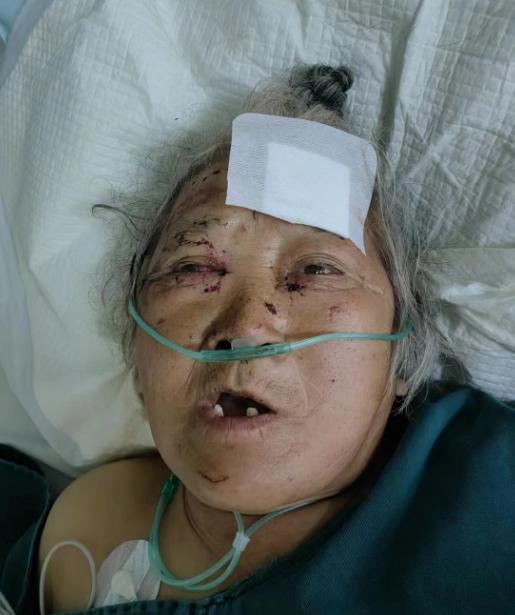走失者照片 患者寻亲：抚顺市七旬老太被送医，白...