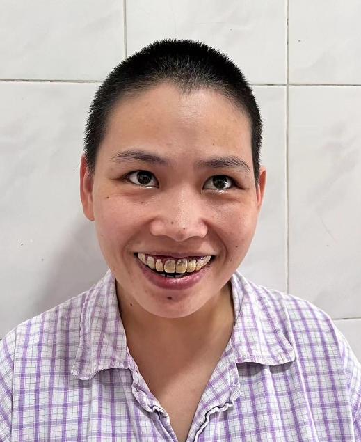 走失者照片 南宁市寻亲：青年女子被救助多年，自...