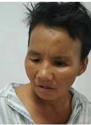 走失者照片 江门市鹤山市寻亲：五旬女子被救助，...