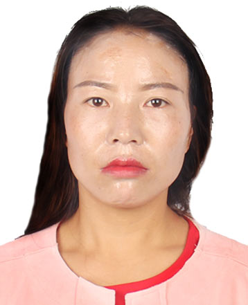 走失者照片 毕节市急寻：青年女子走失，患精神障...