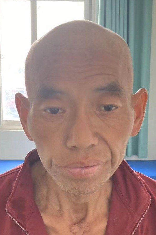 走失者照片 平顶山市寻亲：六旬老人被救助，穿黑...