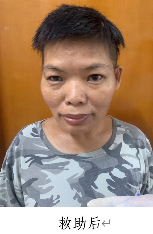 走失者照片 揭阳市寻亲：中年女子被救助，穿白底...