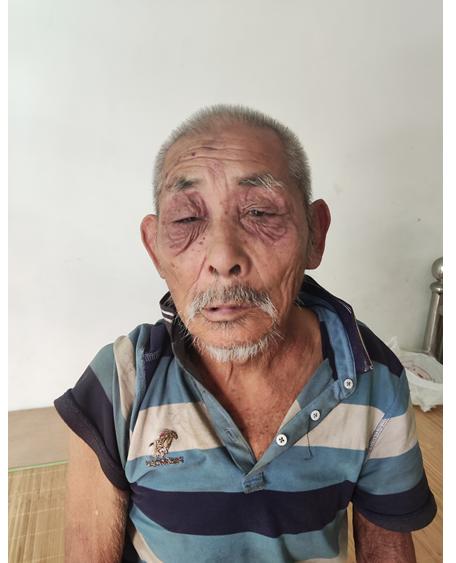 走失者照片 三亚市寻亲：七旬老人被救助，自述叫...