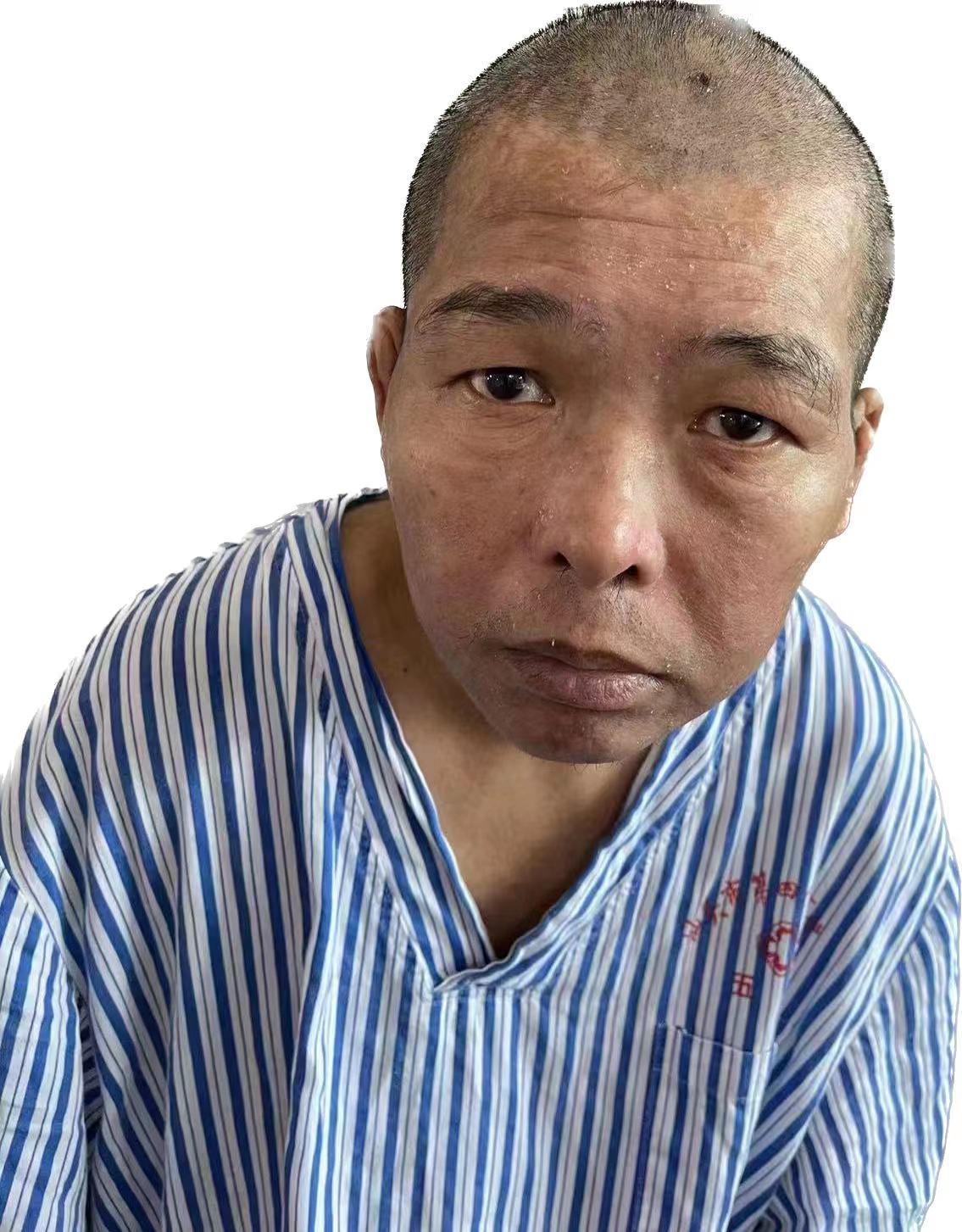走失者照片 寻亲：五旬男子在汕头市被救助，精神...