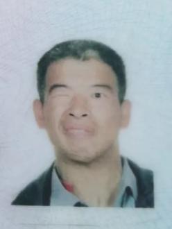 走失者照片 亳州市寻人：中年男子走失，患精神障...