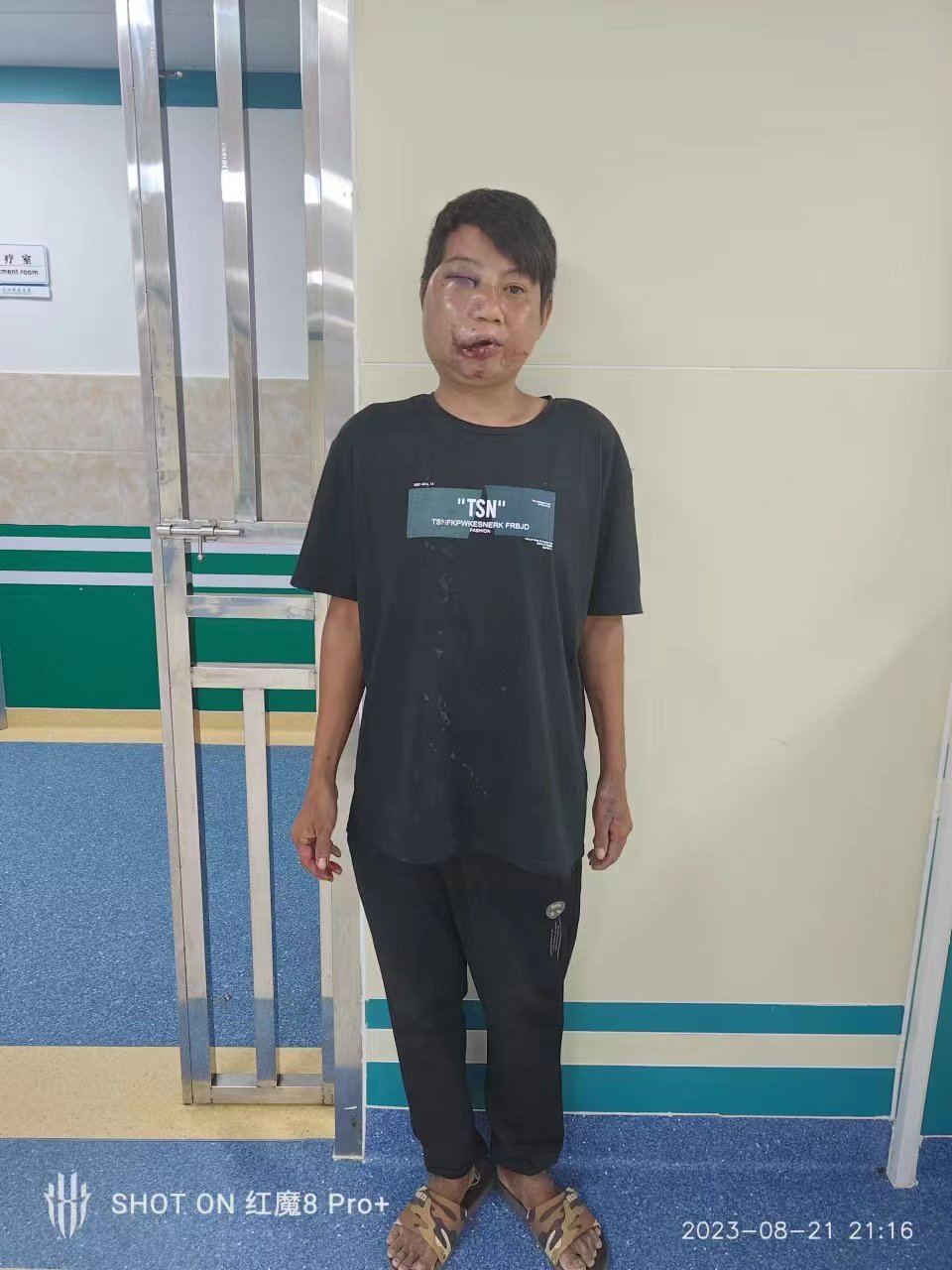 走失者照片 湛江市廉江市寻亲：青年男子被救助，...