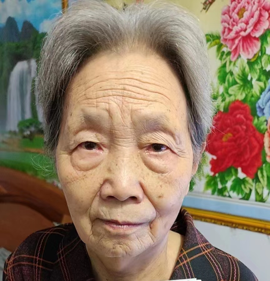 走失者照片 安阳市急寻：八旬老太走失，患小脑萎...