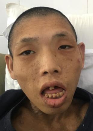 走失者照片 广州市寻亲：青年女子被救助，高1米...