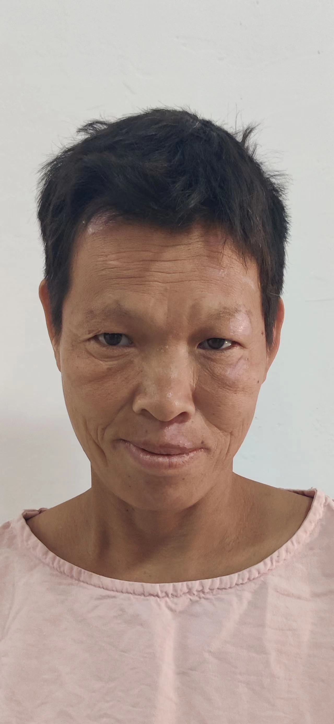 走失者照片 郑州市寻亲：新郑市五旬女子被送医多...