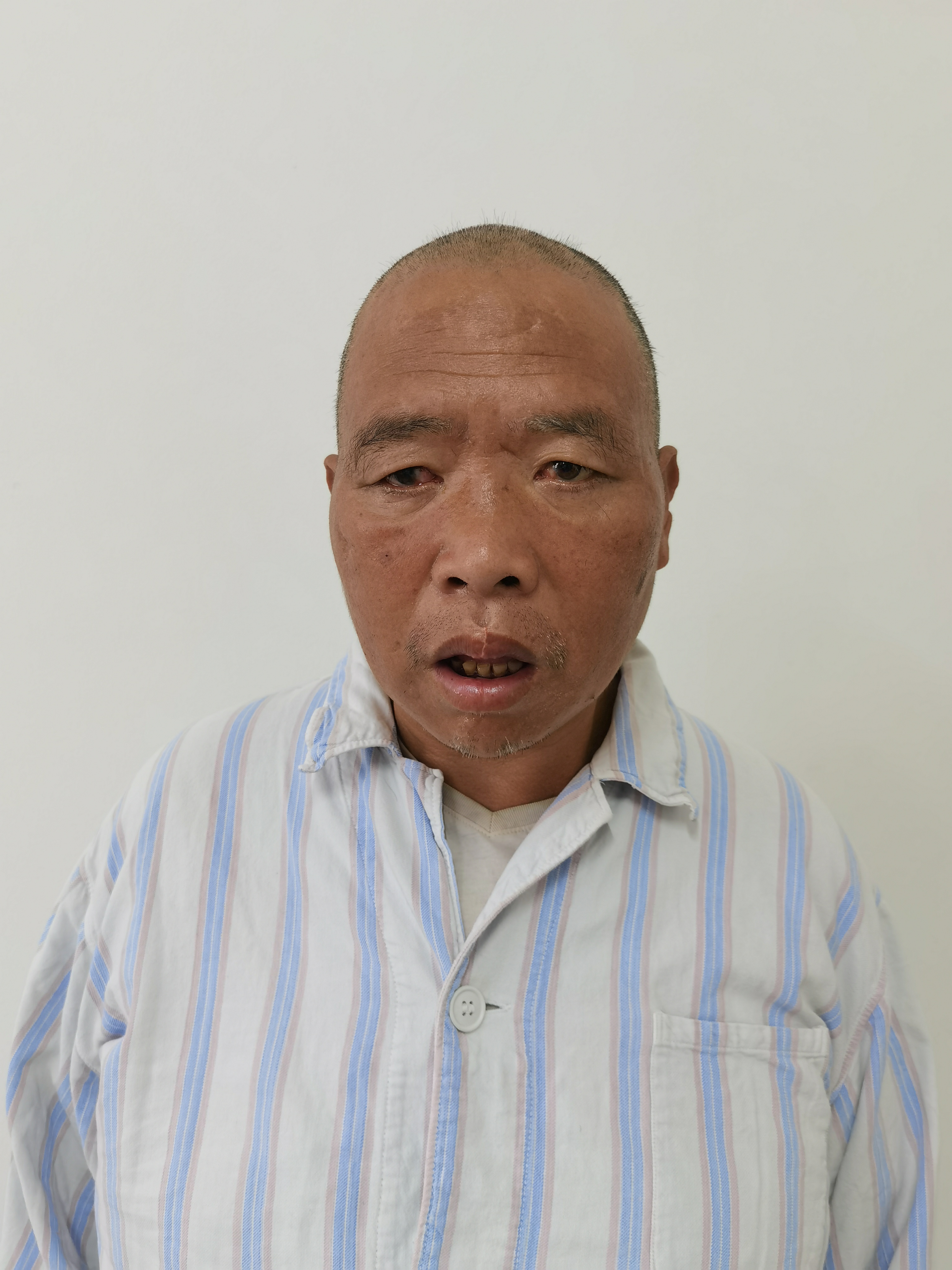 走失者照片 玉溪市寻亲：五旬男子被救助多月，目...