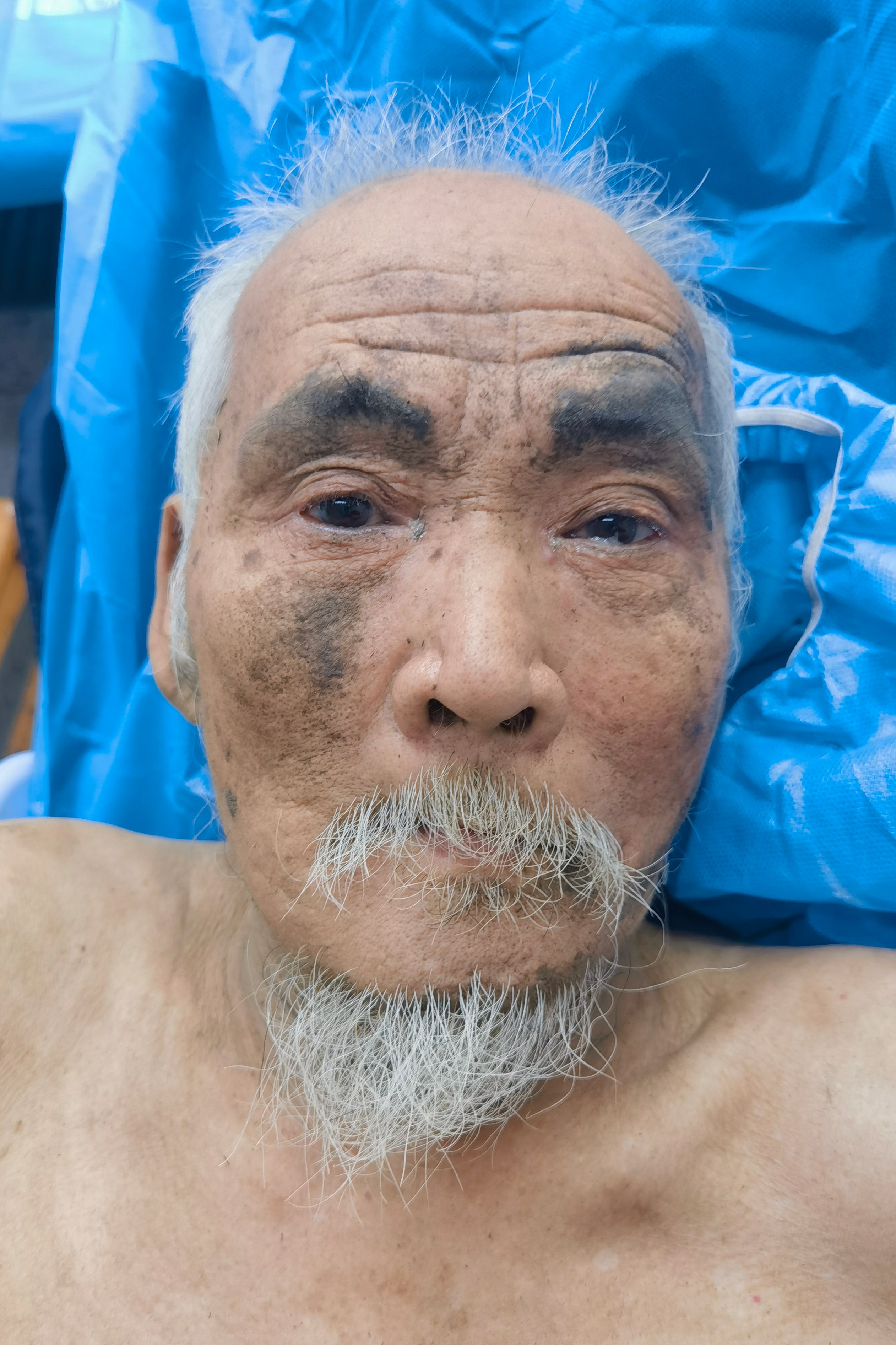 走失者照片 成都市寻亲：八旬老人被救助，自述叫...