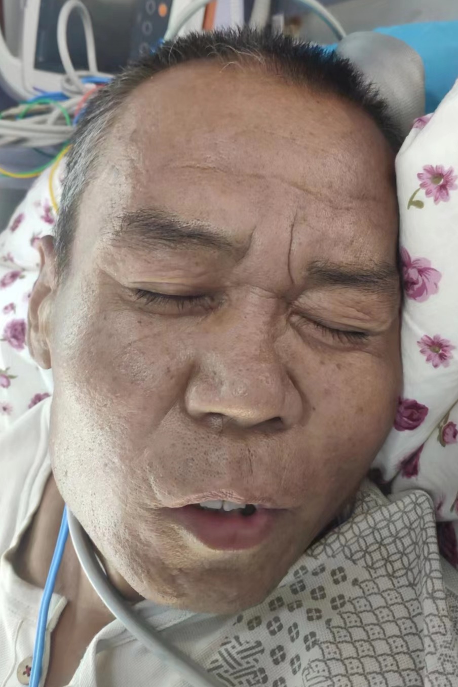 走失者照片 大连市寻亲：五旬男子被救助，穿白色...