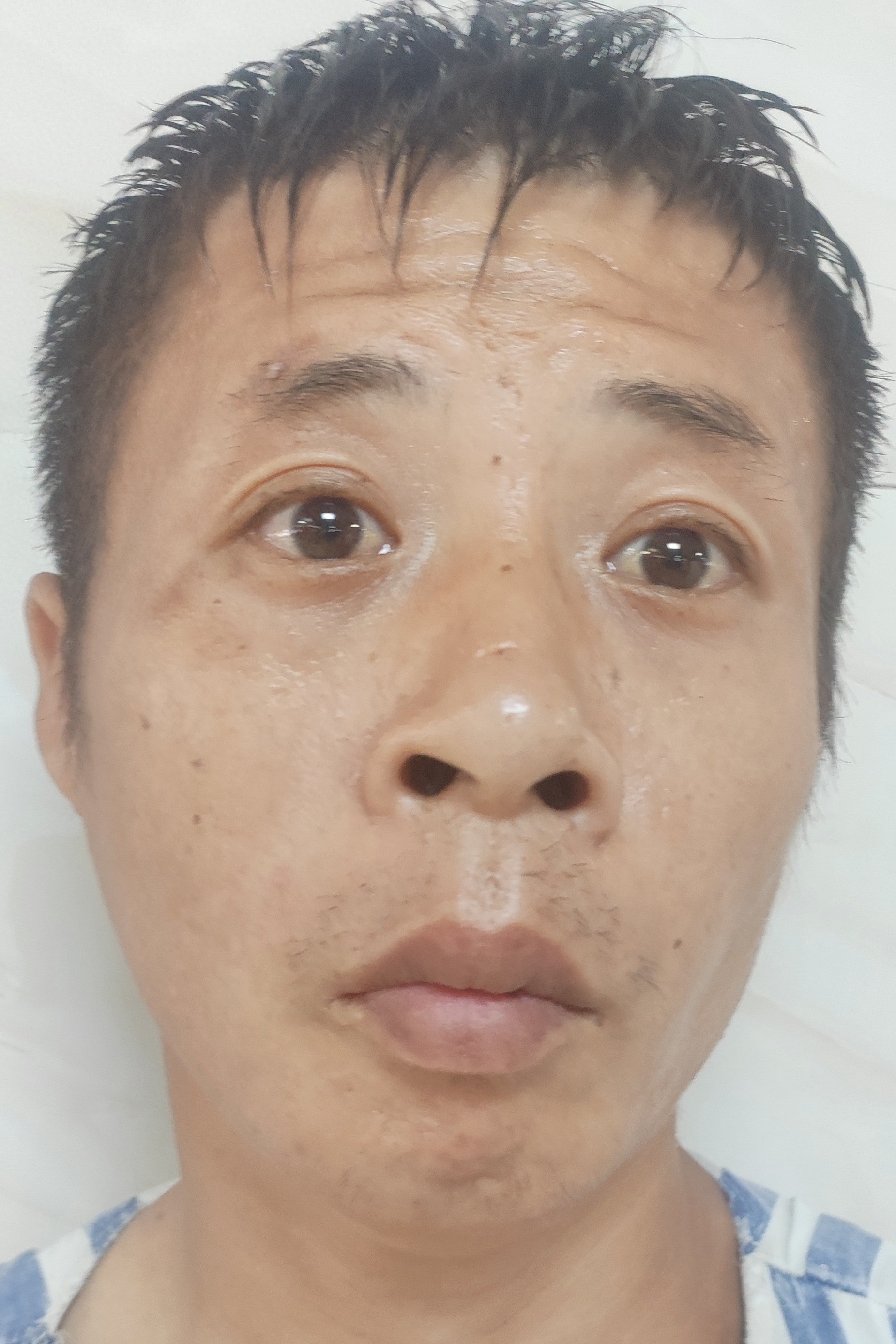 走失者照片 南宁市横州市寻亲：中年男子被救助，...