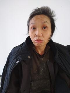 走失者照片 安庆市寻亲：桐城市五旬女子被救助数...