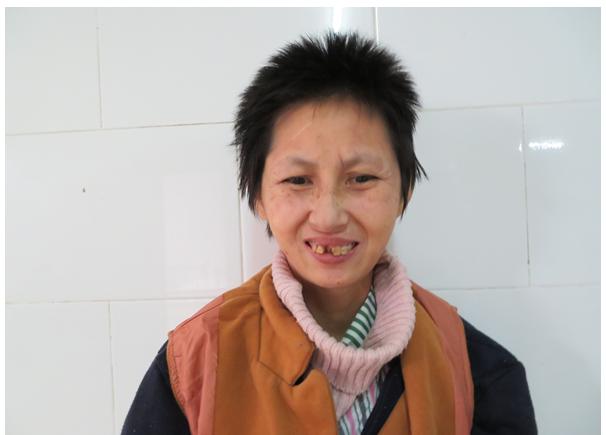 走失者照片 清远市寻亲：中年女子在广州市被救助...
