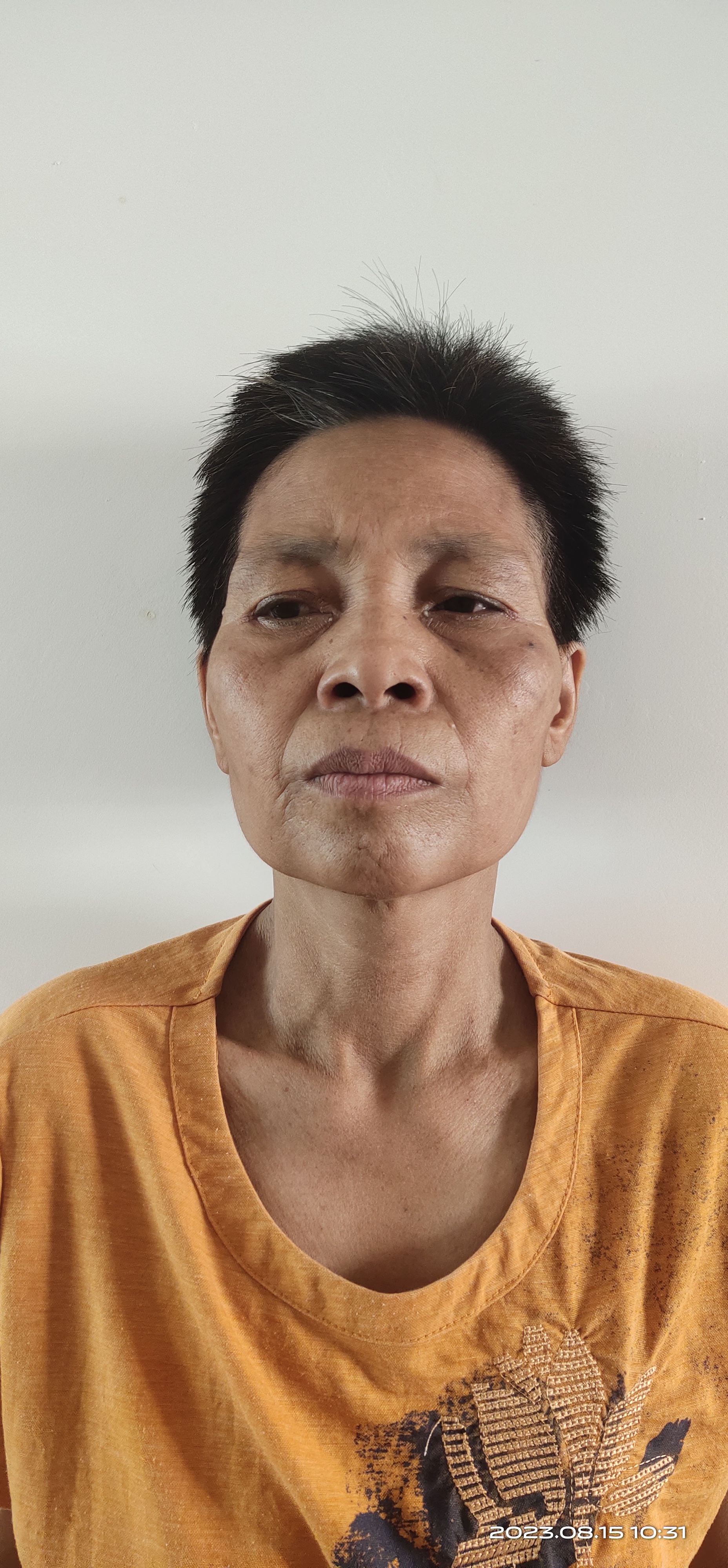 走失者照片 梅州市寻亲：五旬女子被救助，穿黄色...
