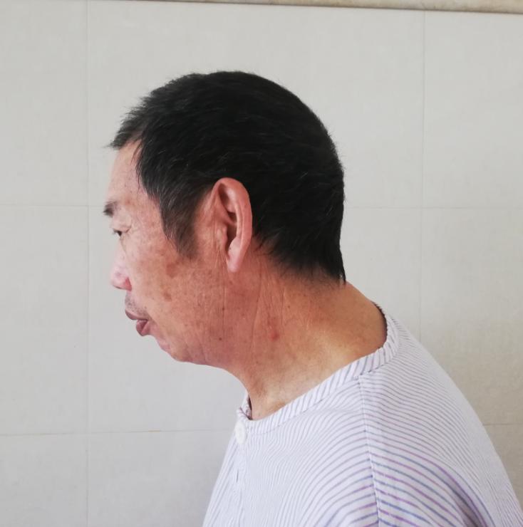 走失者照片 嘉兴市寻亲:六旬老人在海宁市被救助...