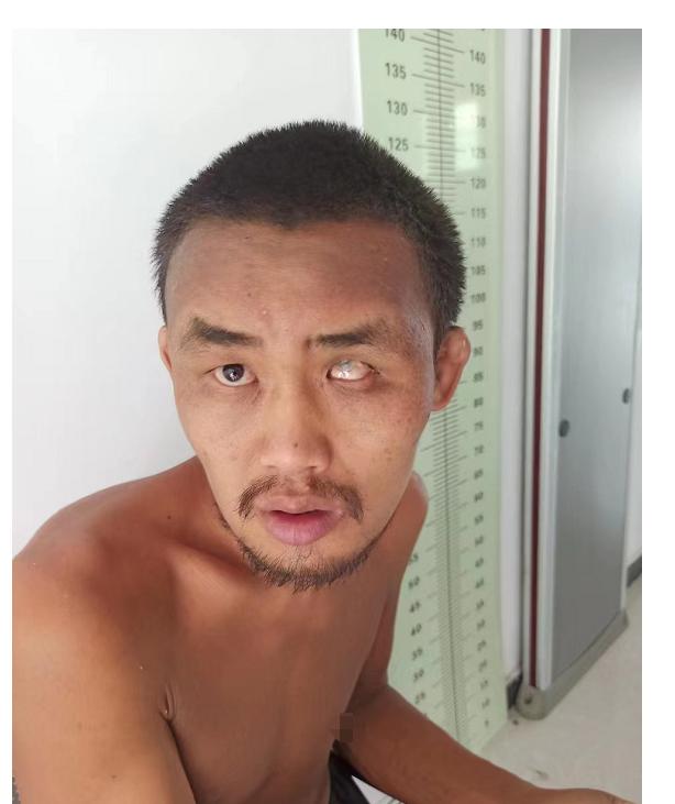 走失者照片 阜阳市寻亲：中年男子被救助，疑似智...