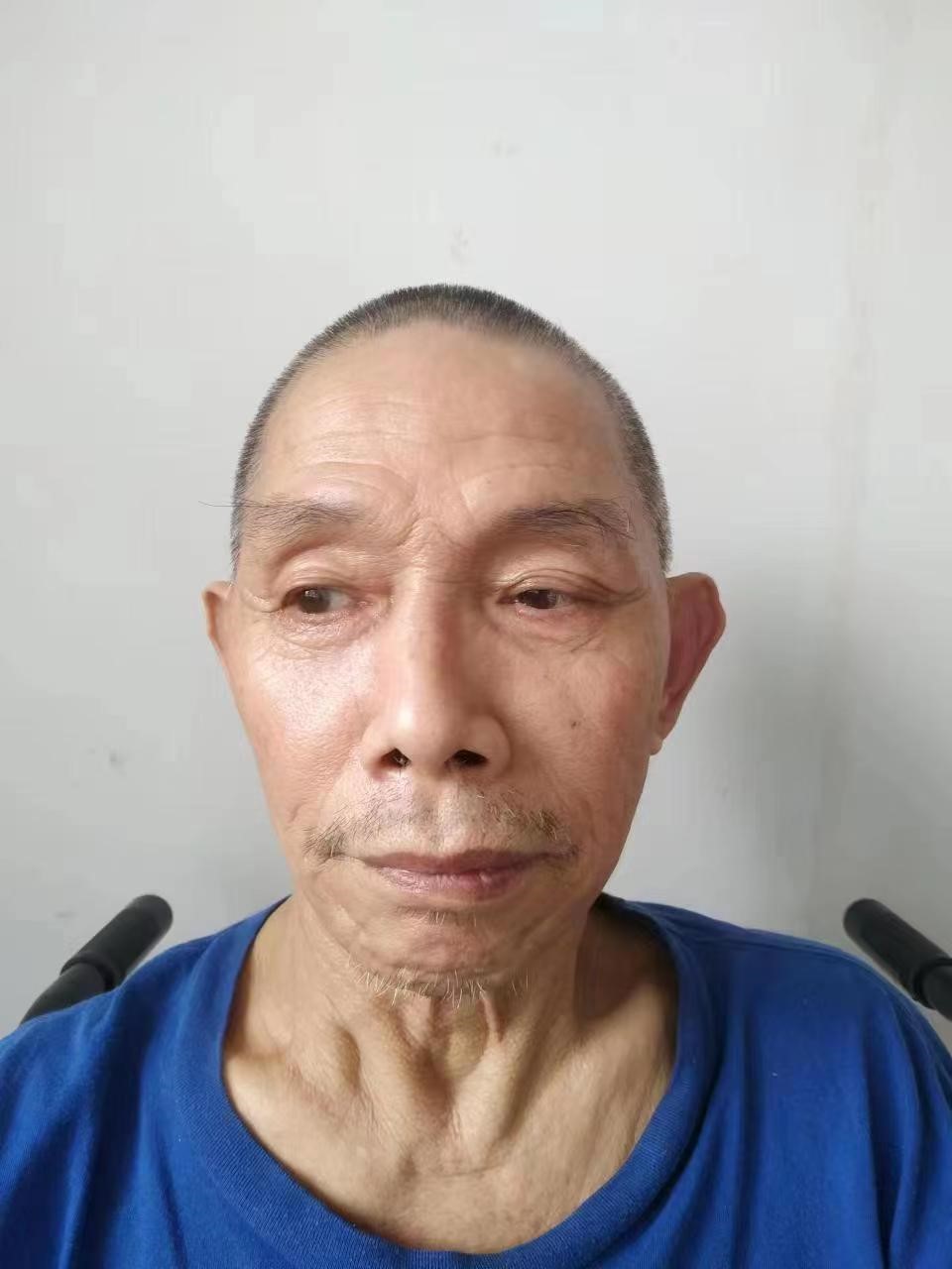 走失者照片 安庆市寻亲：五旬男子在桐城市被救助...