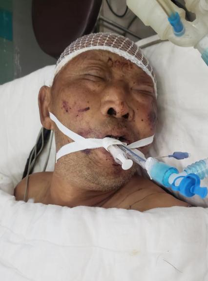 走失者照片 患者寻亲：邢台市六旬老人因车祸被送...