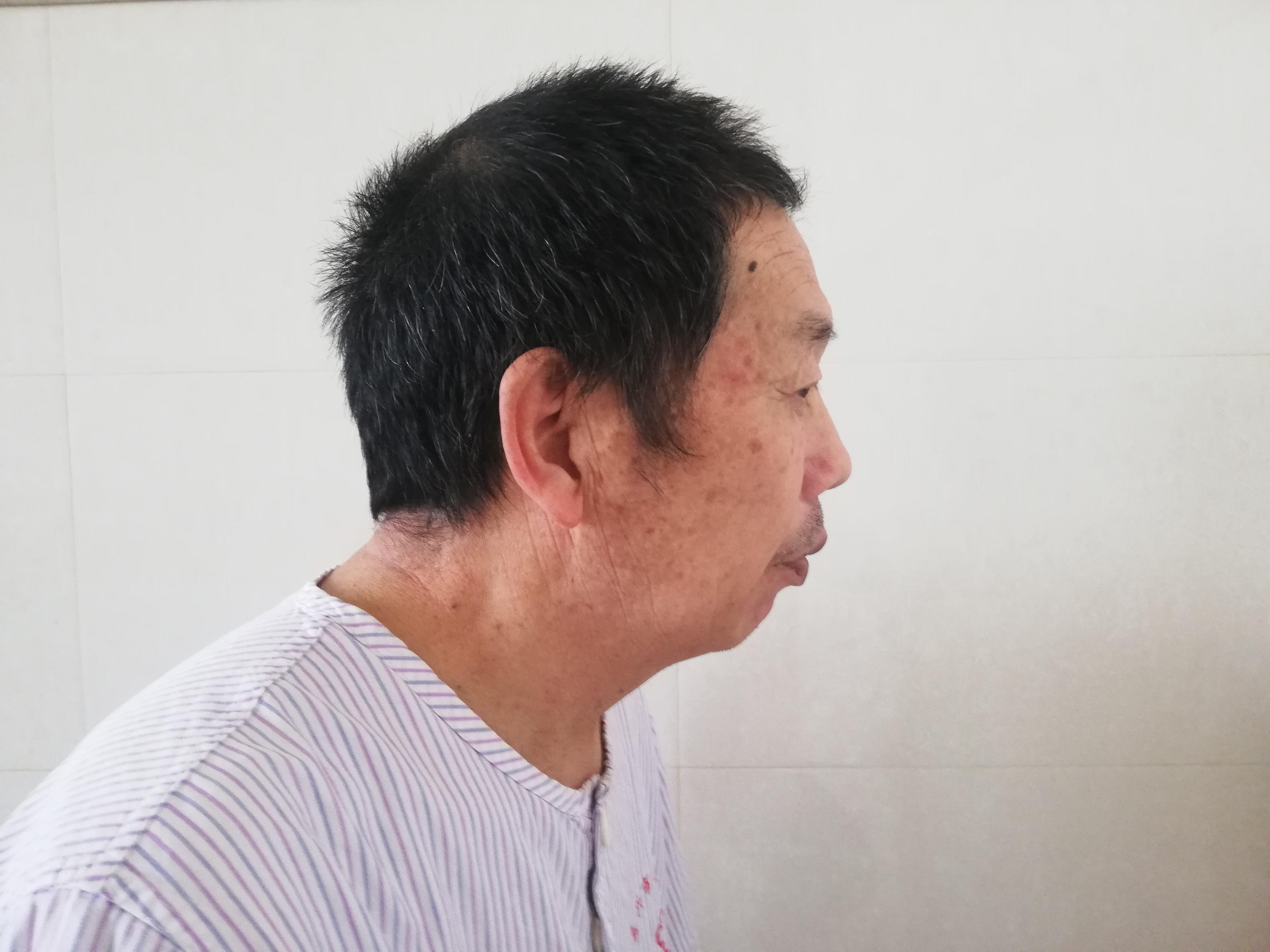 走失者照片 嘉兴市海宁市寻亲：六旬老人被救助，...