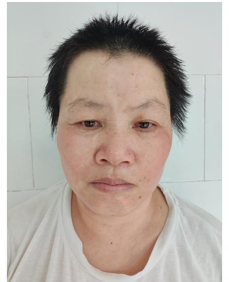 走失者照片 韶关市乐昌市寻亲：中年女子在广州被...