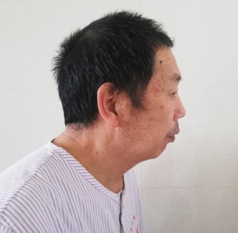 走失者照片 嘉兴市寻亲：六旬老人在海宁市被救助...