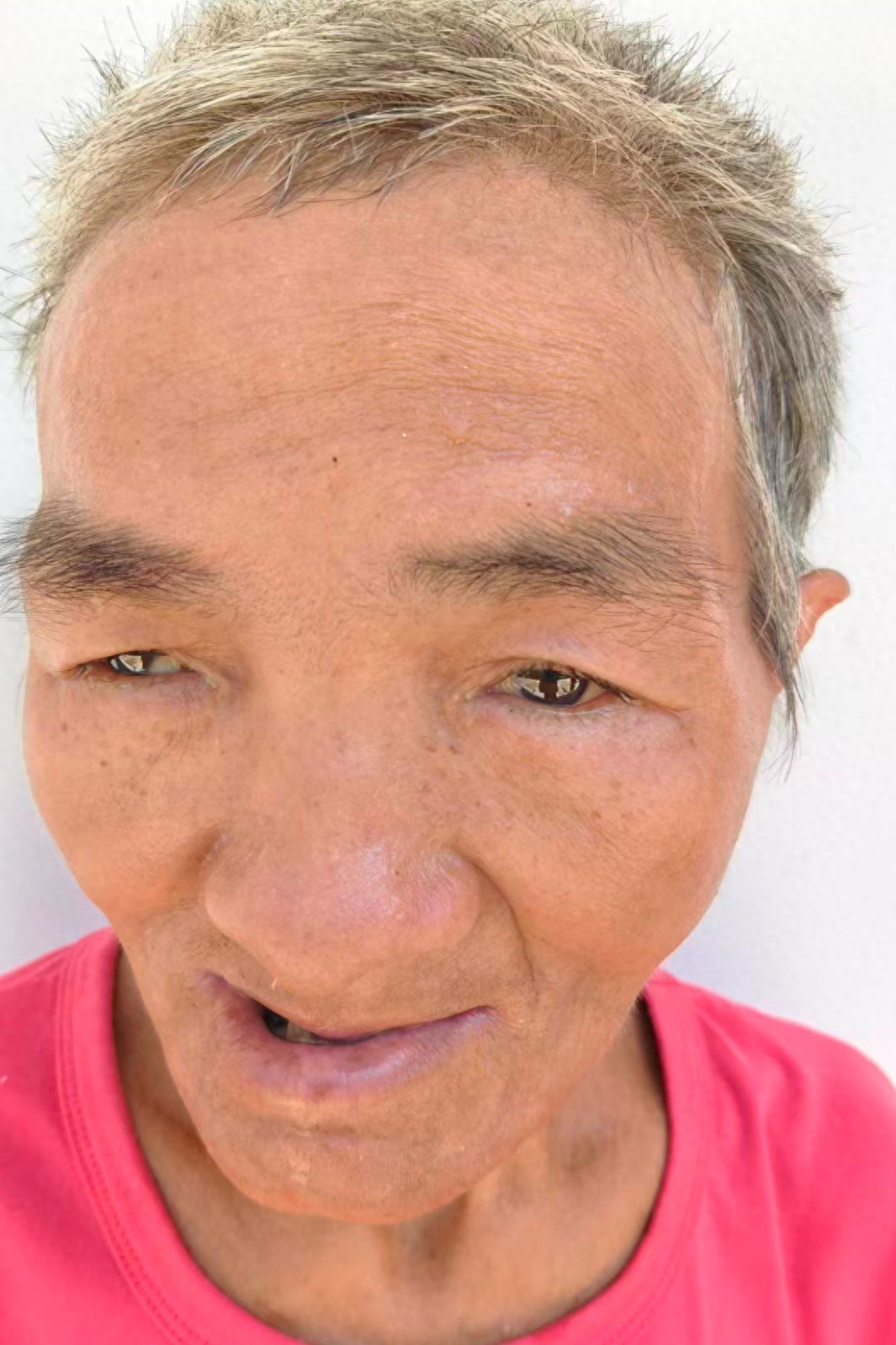 走失者照片 商丘市永城市寻亲：六旬老人被救助，...