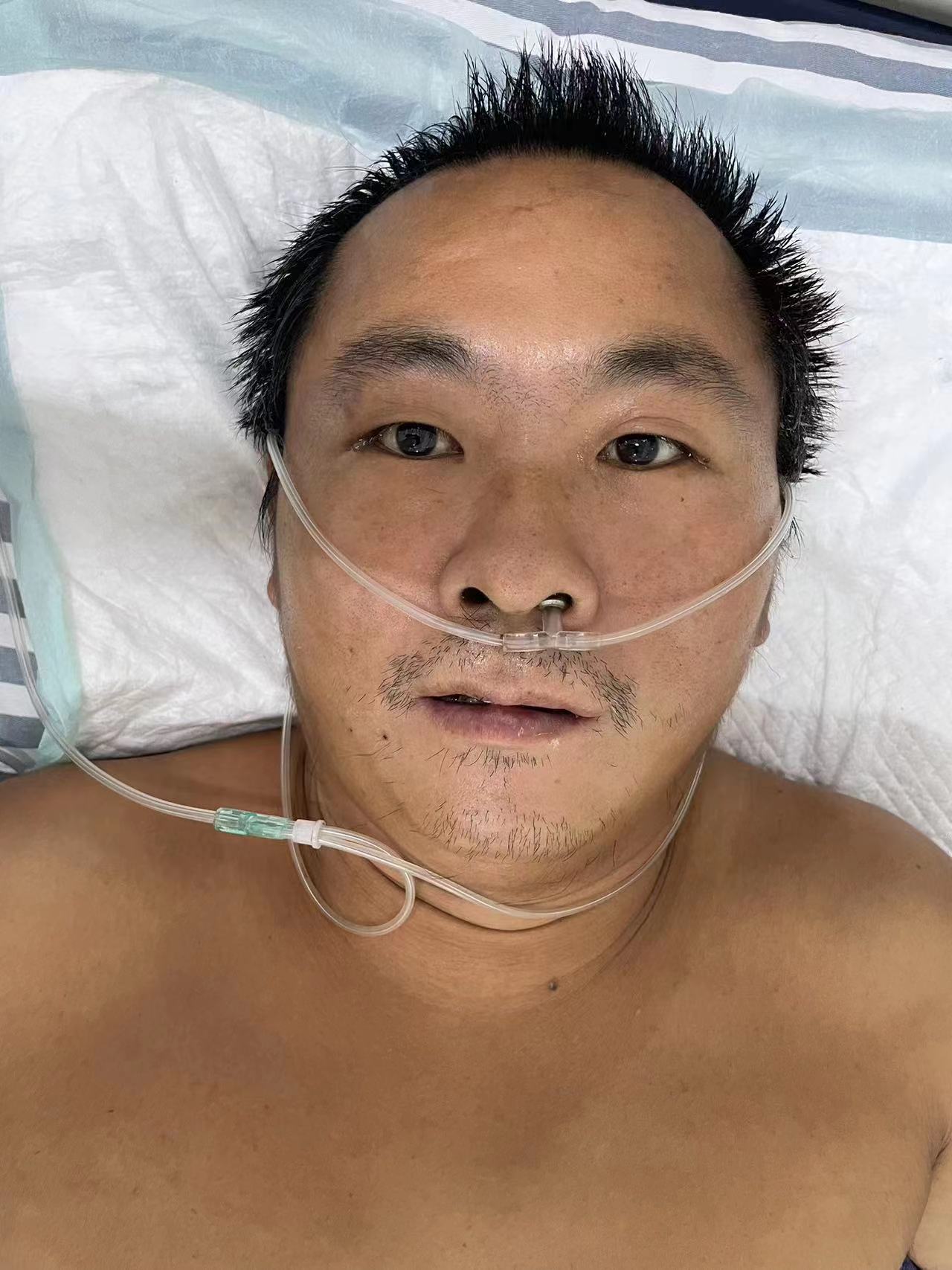 走失者照片 南宁市寻亲：五旬男子被救助，患脑梗...