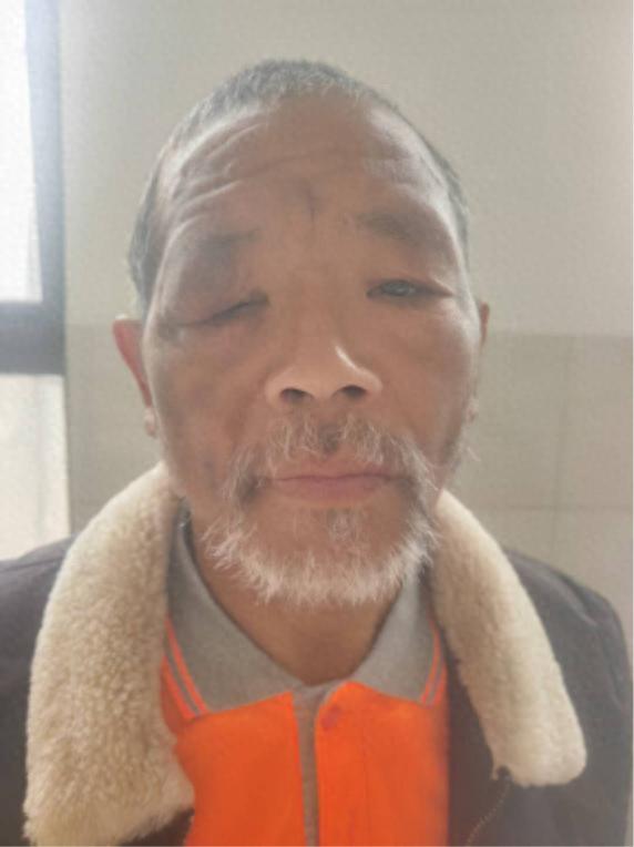 走失者照片 焦作市寻亲：六旬老人被救助，穿黑色...