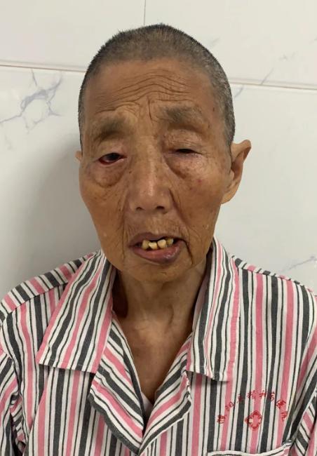走失者照片 帮她回家：濮阳市七旬老太被救助多日...