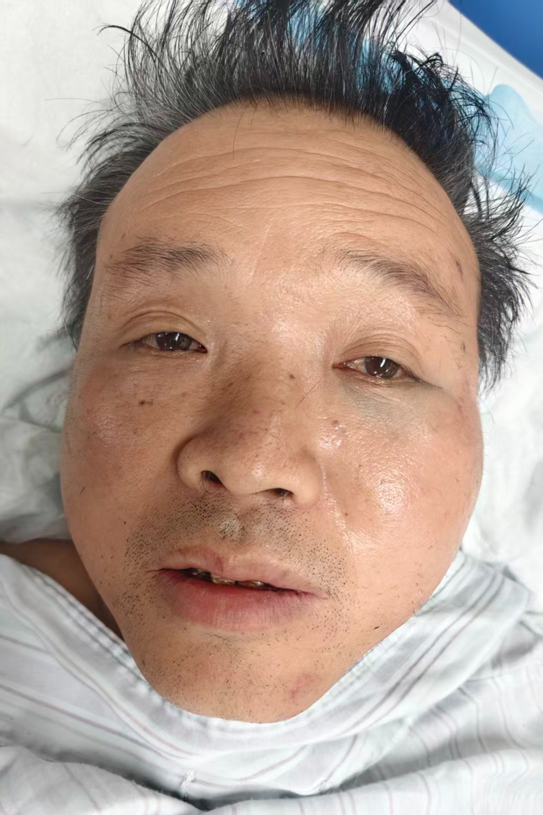 走失者照片 全国救助站