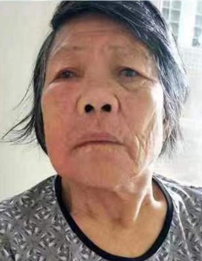 走失者照片 汕头市急寻：七旬老太失联，穿灰蓝底...