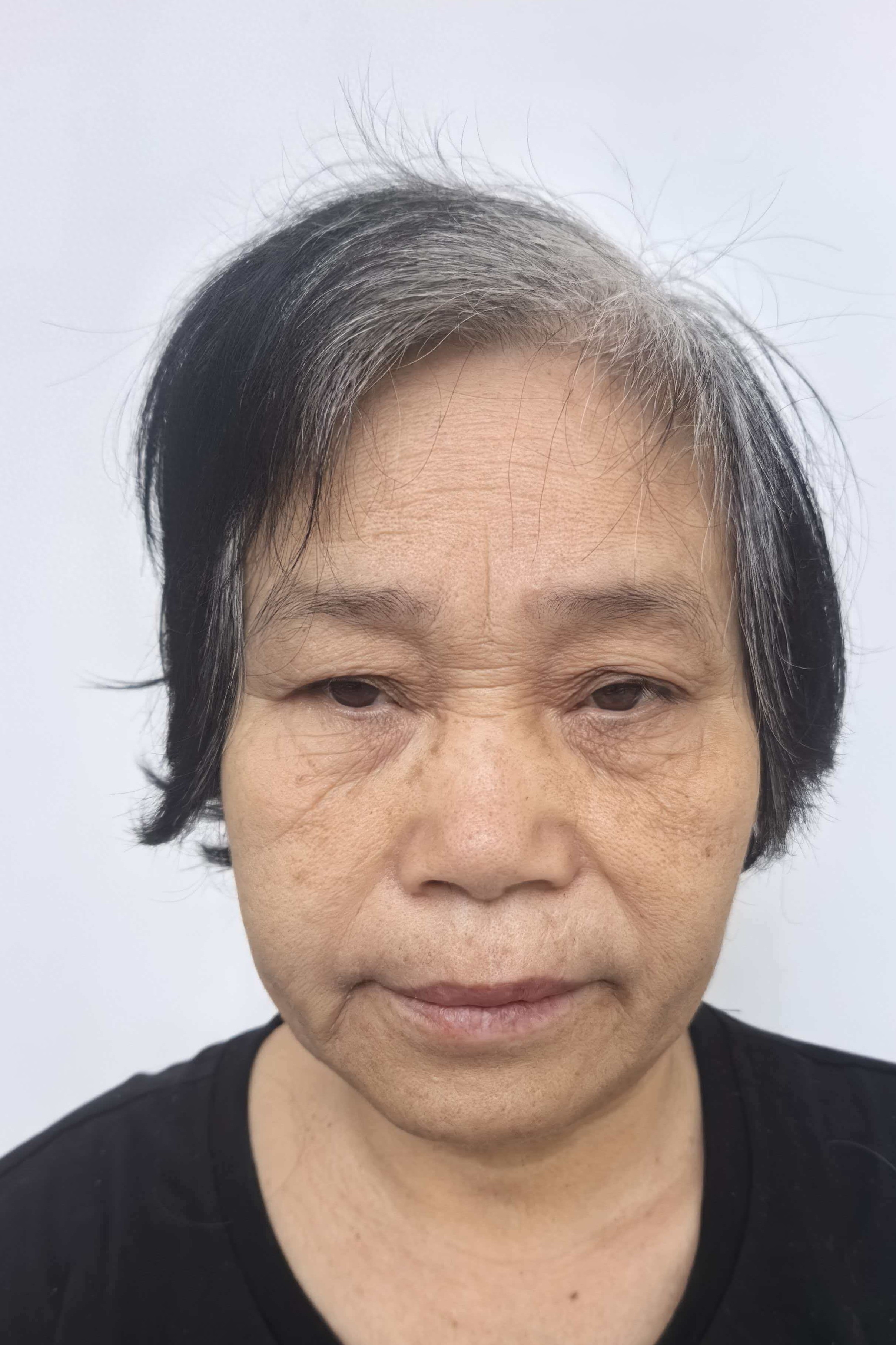 走失者照片 周口市寻亲：五旬女子被救助，受助时...