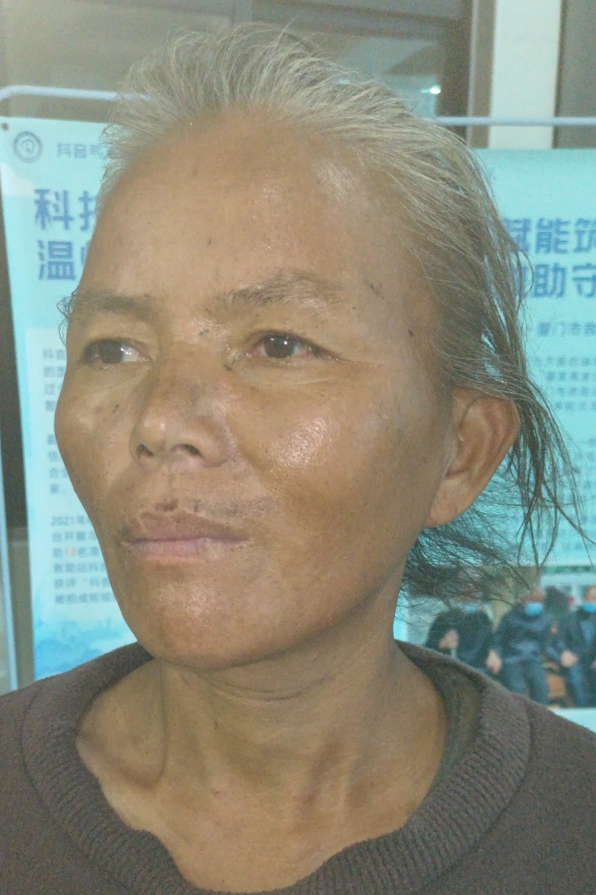 走失者照片 厦门市寻亲：五旬女子被救助，花白头...