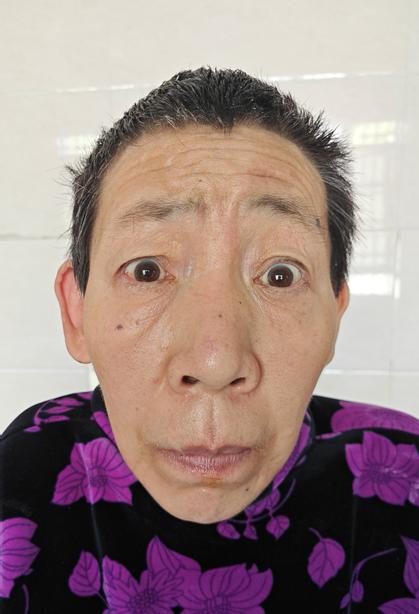 走失者照片 铜陵市寻亲：六旬老太被救助十余年，...