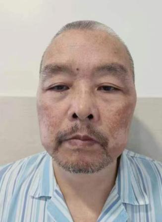 走失者照片 宣城市广德市寻亲：五旬男子被救助多...