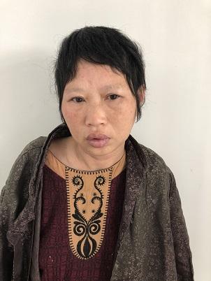 走失者照片 淮南市寻亲：中年女子被救助多年，无...