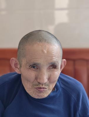 走失者照片 铜陵市寻亲：七旬老人被救助多年，左...