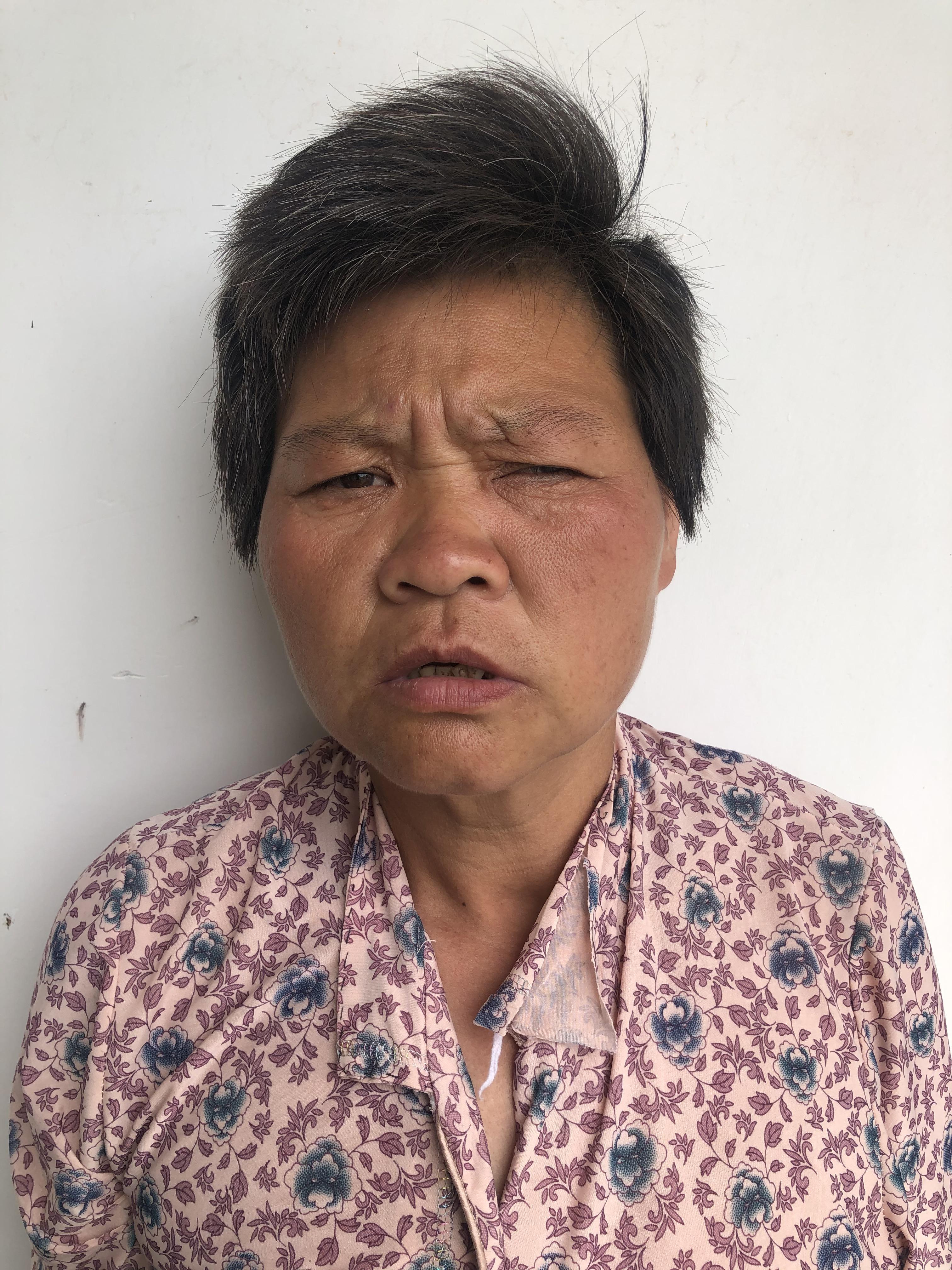 走失者照片 淮南市寻亲：中年女子被救助，沟通困...
