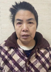 走失者照片 衡阳市寻亲：五旬女子被救助多日，高...