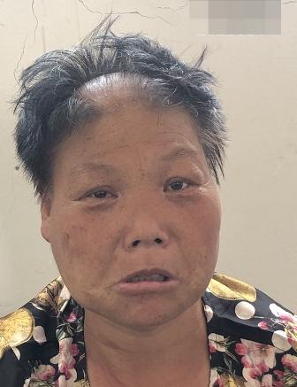 走失者照片 淮南市寻亲：中年女子被救助多年，语...