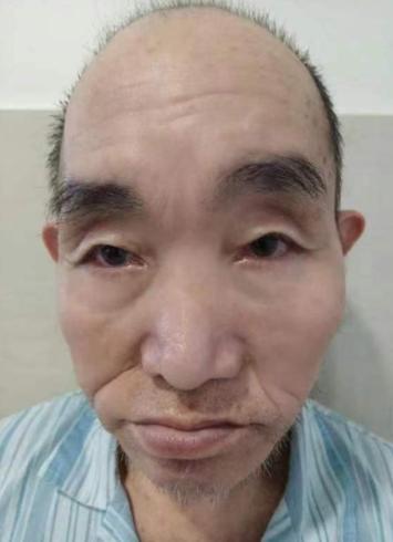 走失者照片 宣城市广德市寻亲：中年男子被救助多...