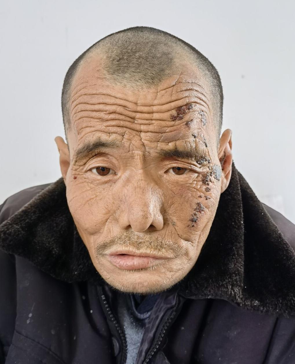 走失者照片 淮南市寻亲：五旬男子被救助多年，患...