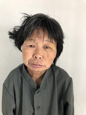 走失者照片 淮南市寻亲：六旬老太被救助多年