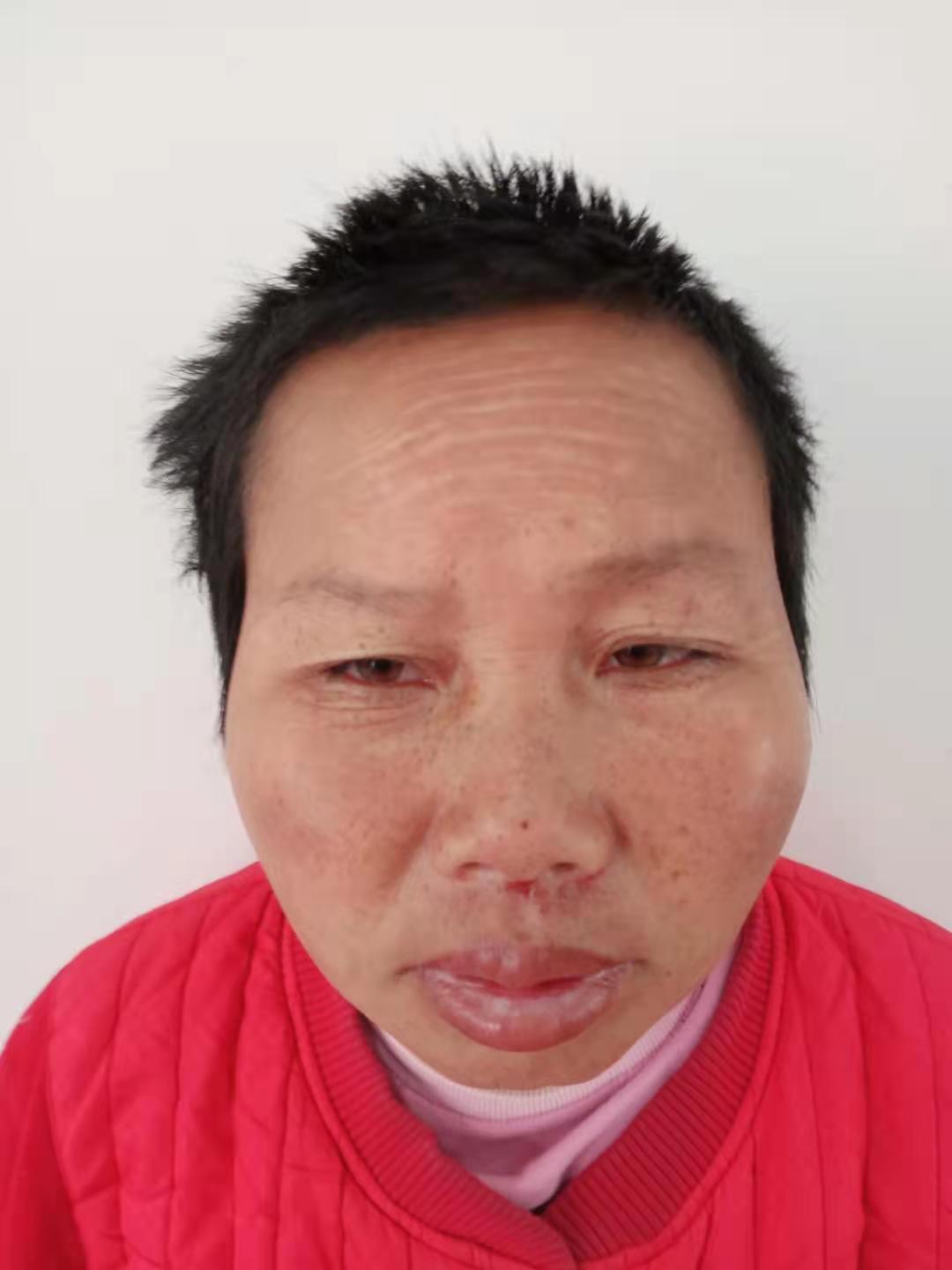 走失者照片 淮南市寻亲：中年女子被救助，自述叫...