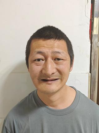 走失者照片 铜陵市寻亲：中年男子被救助多年，头...