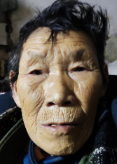 走失者照片 昭通市寻亲：七旬老人被救助，自述叫...