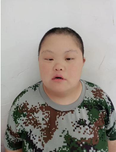 走失者照片 济南寻亲：青年女子被救助，疑患唐氏...