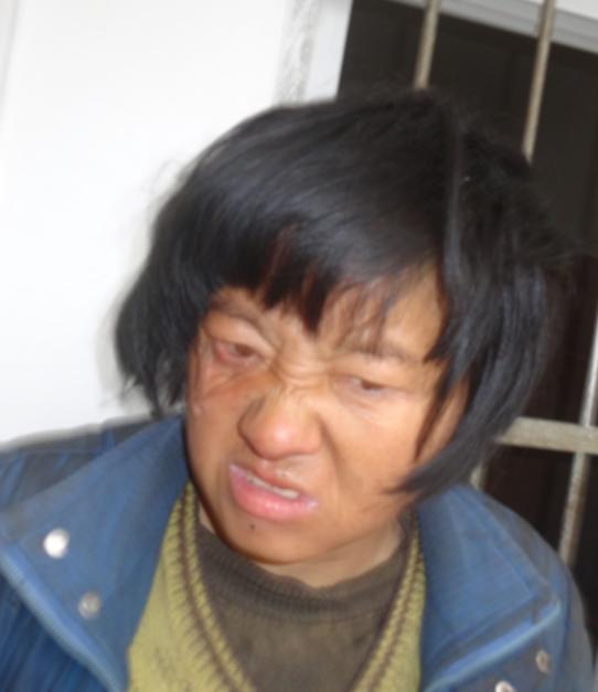 走失者照片 安庆市寻亲：中年女子被救助多年，不...